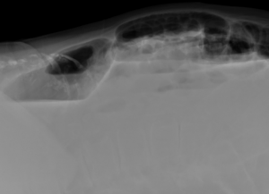 Radiografía en decúbito lateral