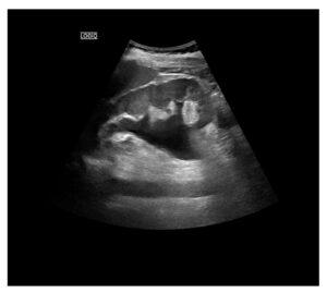 Ecografia abdominal