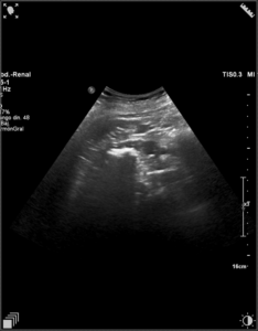 Ecografía abdominal